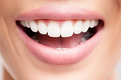 a smiling patient who has had crown lengthening at Solutions Dental Implants 